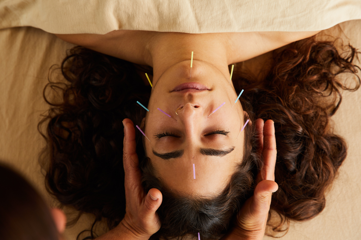 What Can Acupuncture Help With?